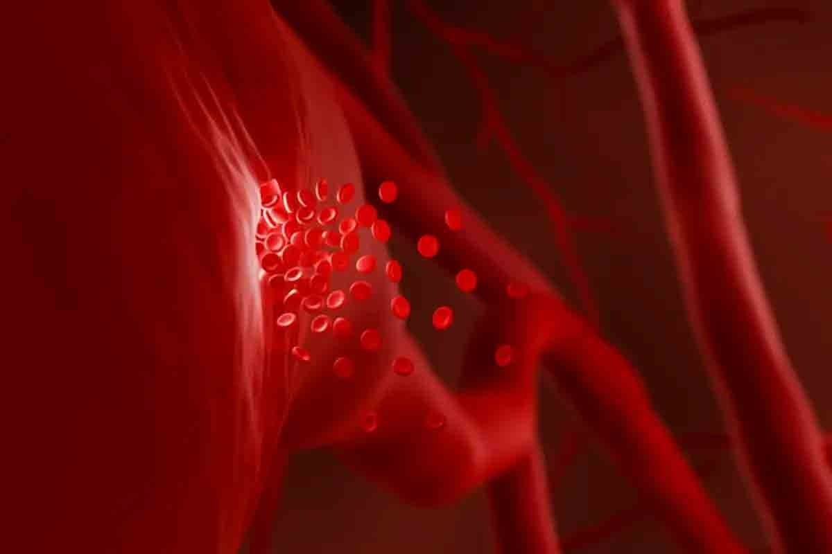 types of bleeding disorders — 9 Common Conditions Explained