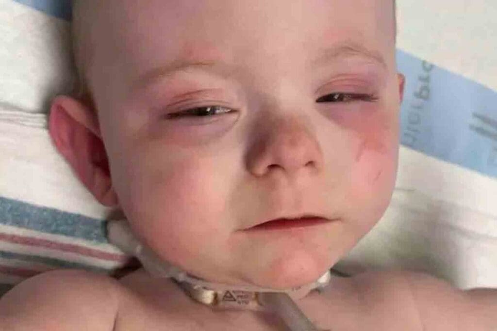 signs of infantile leukemia — 10 Key Symptoms 2025