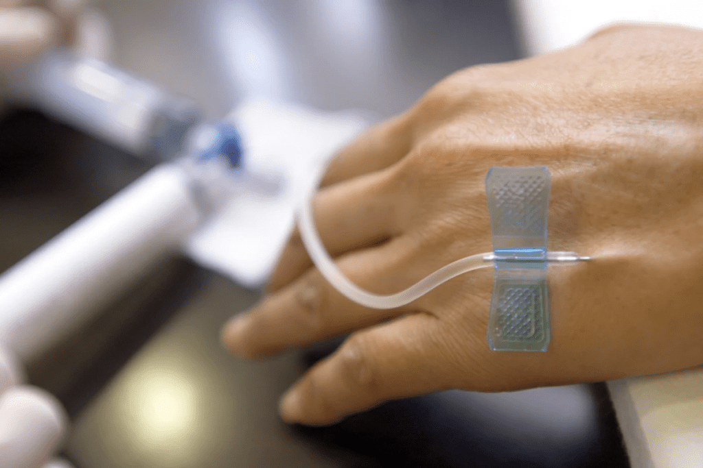 Chemotherapy Side Effects: Cold Water Pain