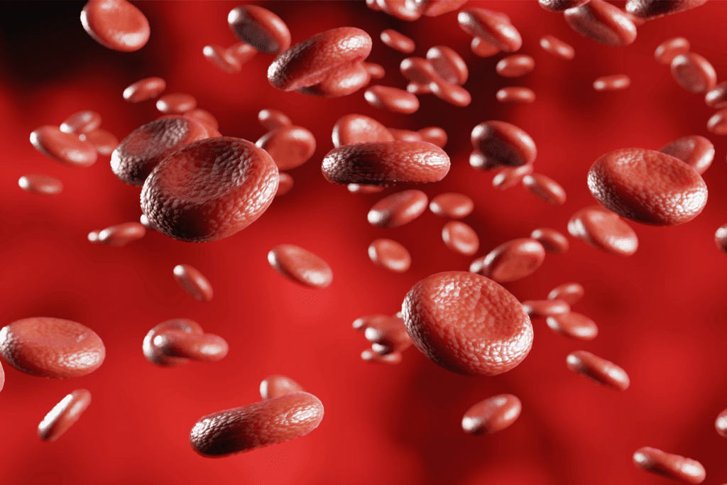 What Is Anemia: Expert Important Causes 2 What Is Anemia: Expert Important Causes