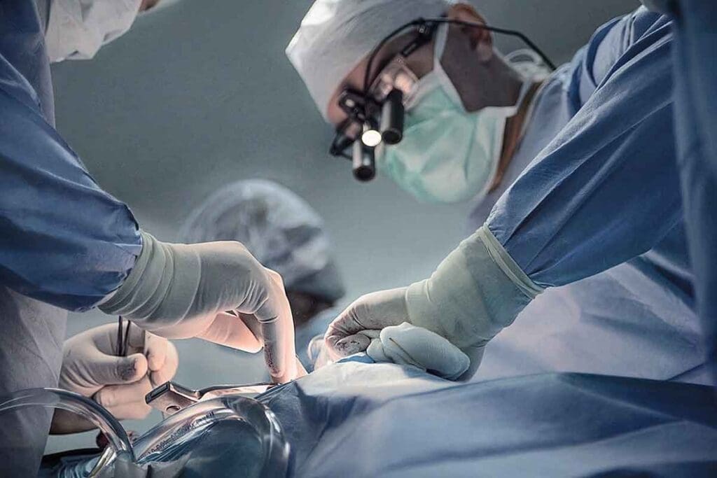 Abdominal Aortic Aneurysm Stent Graft: 7 Key Facts