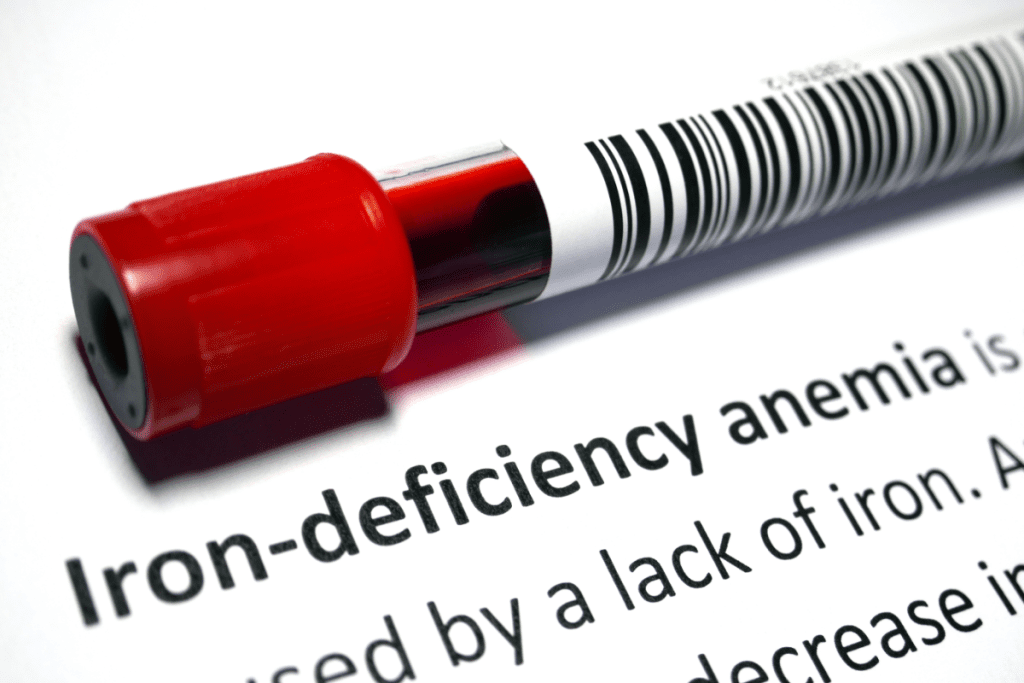 Iron Supplements: Ultimate Positive Treatment Fix