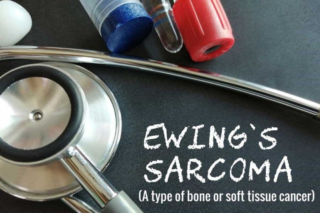 Early Sign Ewing Sarcoma Skin: 7 Key Signs 2 Early Sign Ewing Sarcoma Skin: 7 Key Signs
