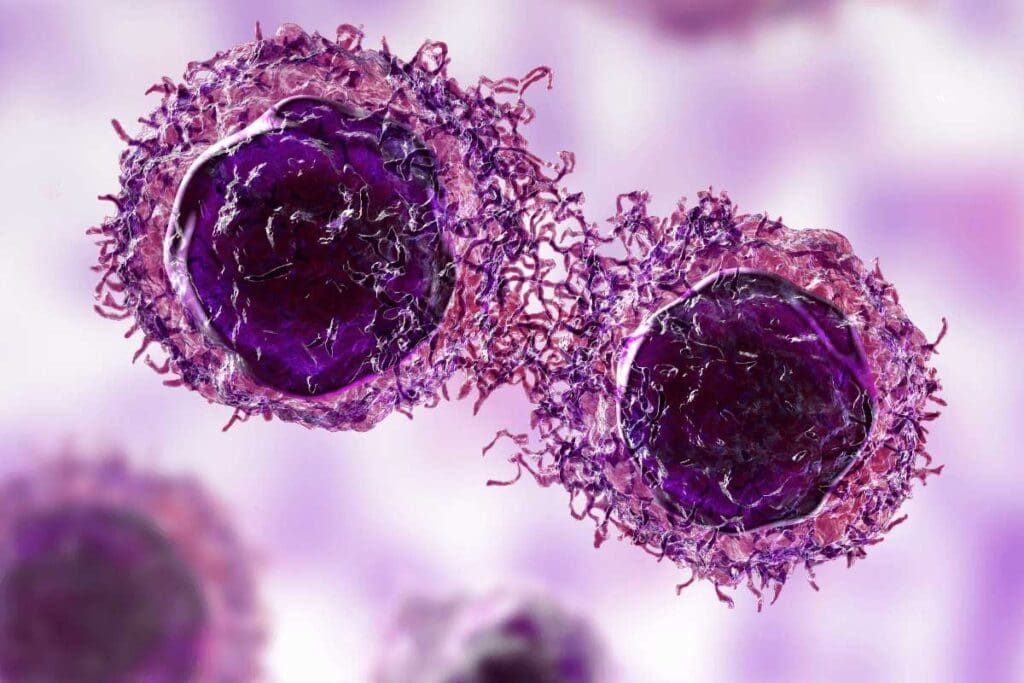 Ewing Sarcoma Lump: Appearance & Feel