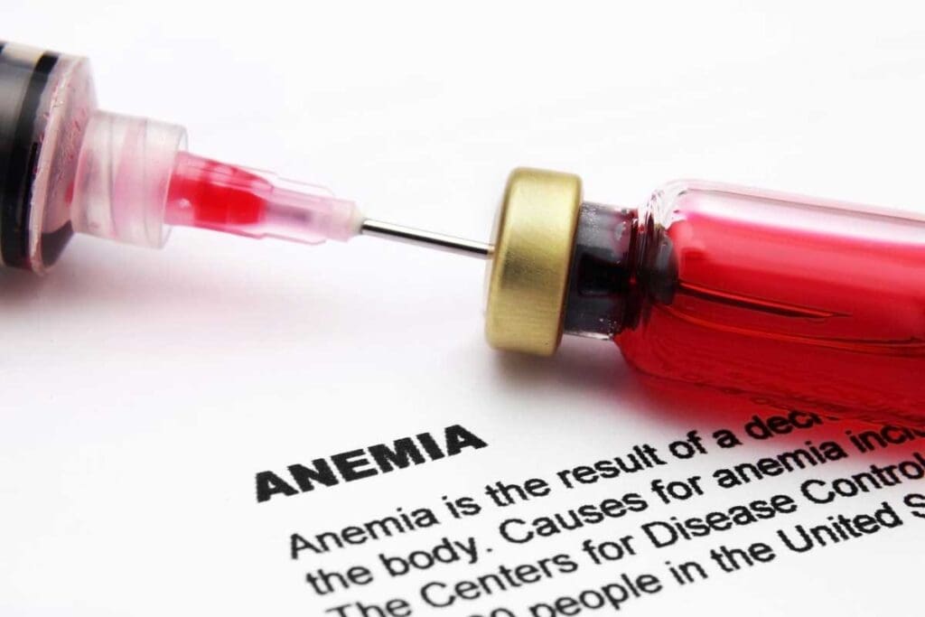 could you die from anemia – Causes & Risks Explained 1 could you die from anemia – Causes & Risks Explained