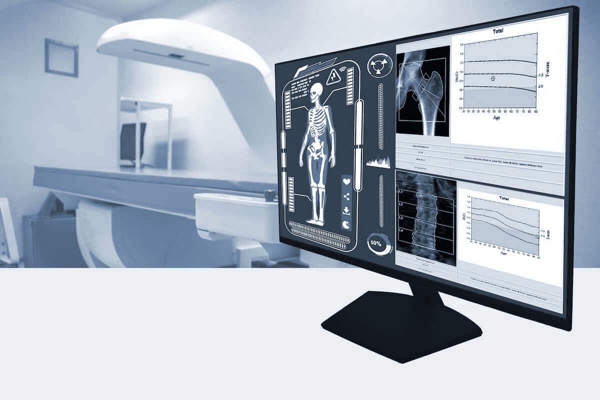 Does Uptake on a Bone Scan Mean Cancer?