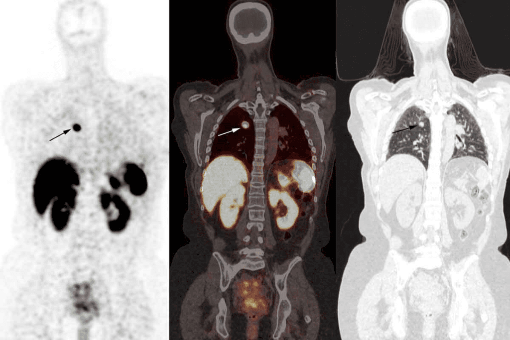 How Long Does a Bone Scan Take?