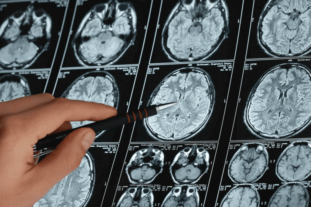 15 Essential Brain Tumor MRI Scan Datasets and Images for Research