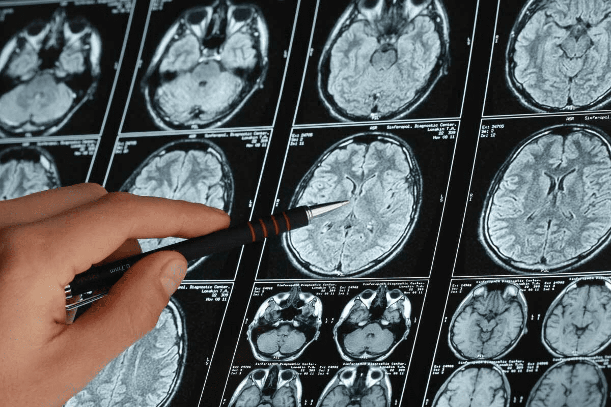 15 Essential Brain Tumor MRI Scan Datasets and Images for Research
