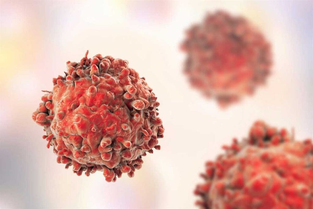 Low Blood Platelets Leukemia: 12 Early Signs