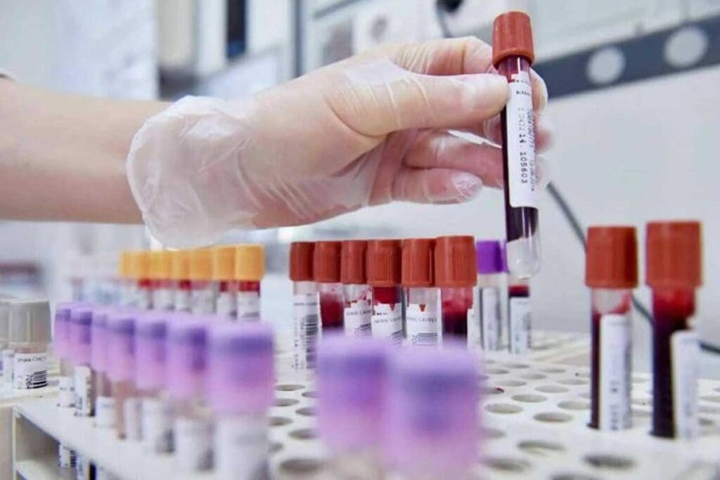 Acute Lymphocytic Leukemia Diagnosis: 8 Essential Labs