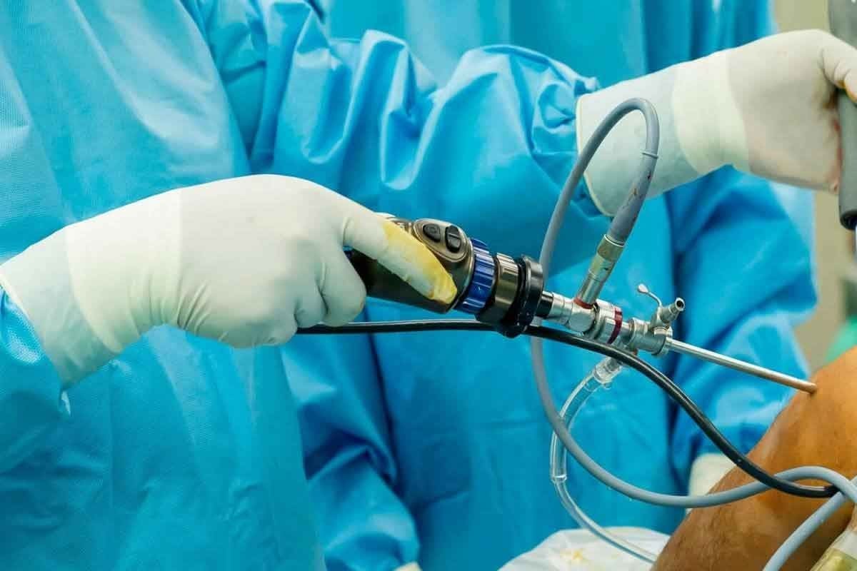 Stenosis Artery Treatment: 7 Key Facts