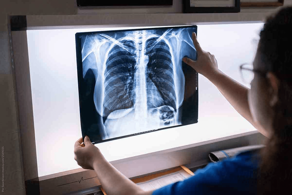 CT Scan Chest With Contrast: Essential Findings & Comparison