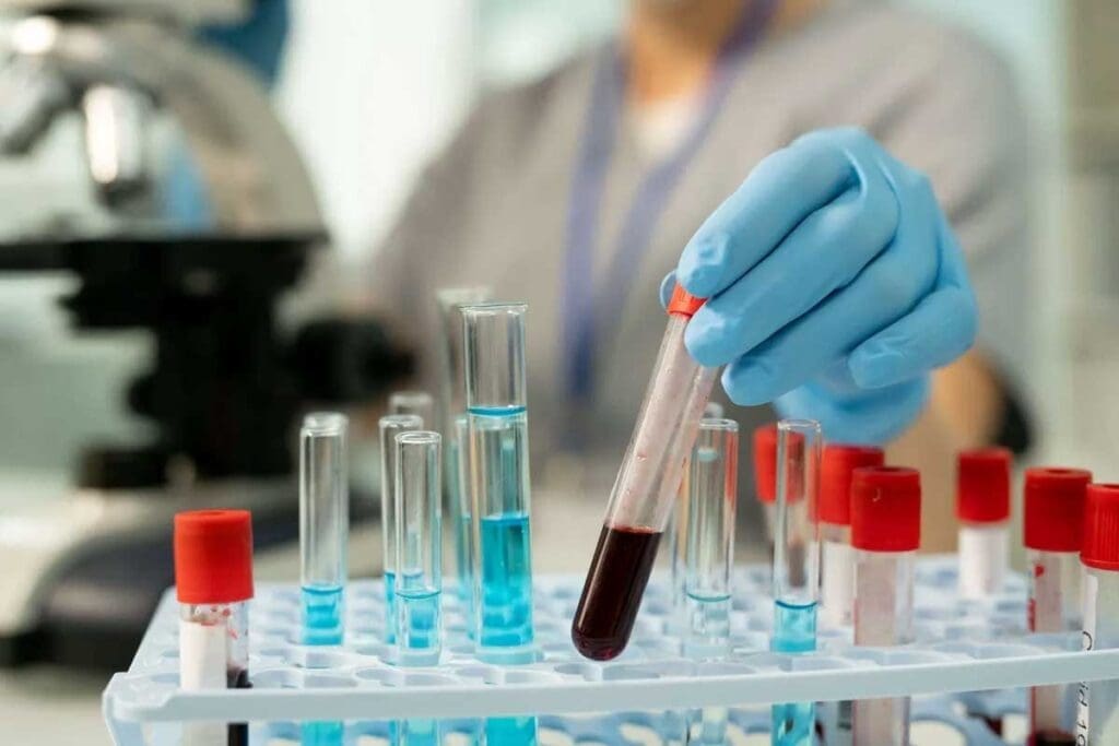 Does Blood Cancer Show Up in Routine Blood Work