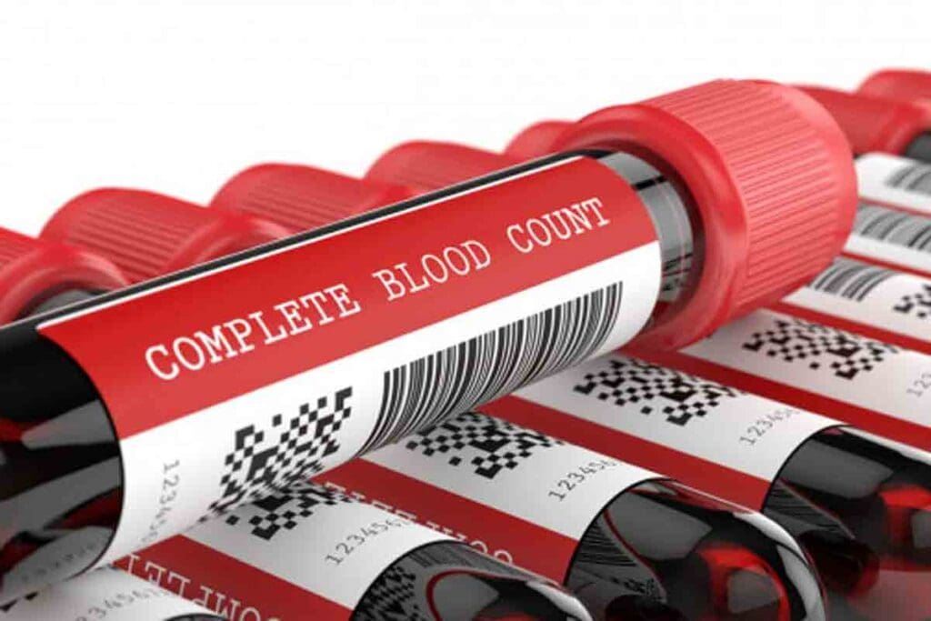 What Blood Test Shows Anemia and Iron Deficiency Levels 3 What Blood Test Shows Anemia and Iron Deficiency Levels