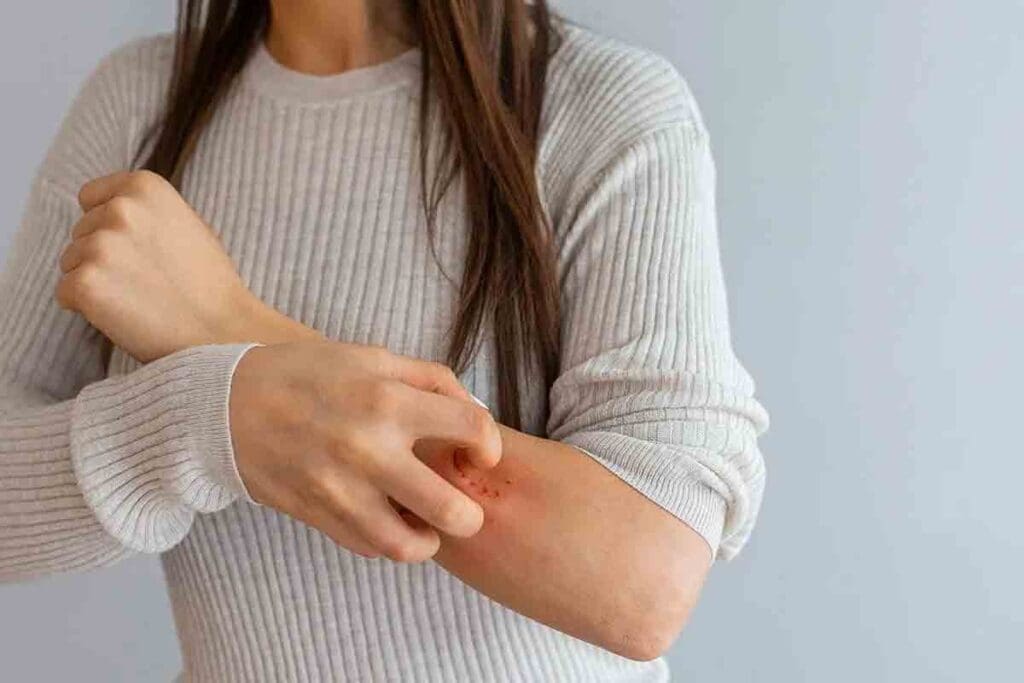 Bruising and Itchy Skin: Causes Explained