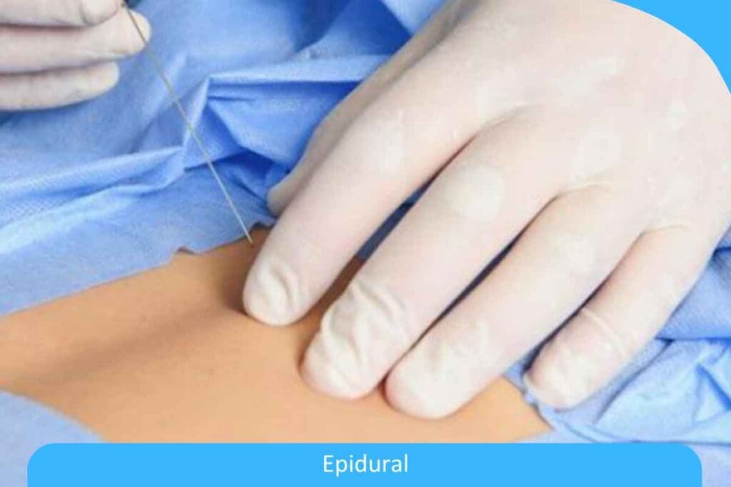 Why No Heat After Epidural Steroid Injection Matters