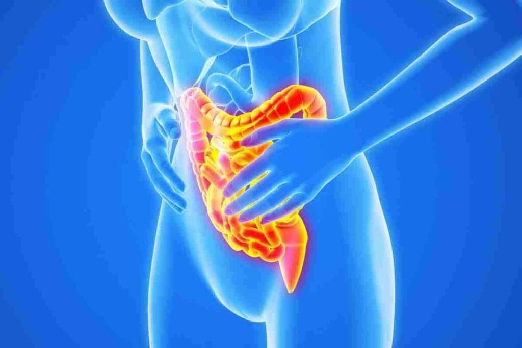 Large Bowel Adhesions: 8 Key Facts on Pain & Risks