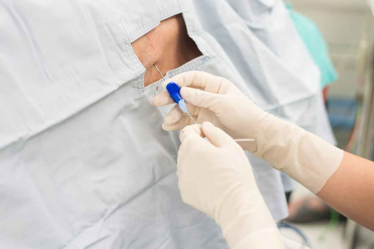 Why Is There No Pain Relief After Epidural Steroid Injection? Causes, Timeline, and Next Steps