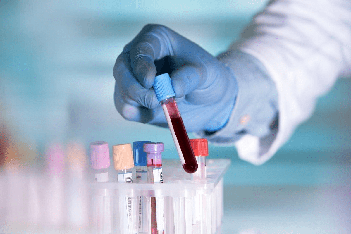 Complete Blood Count: Why Your Doctor Orders This Powerful Test