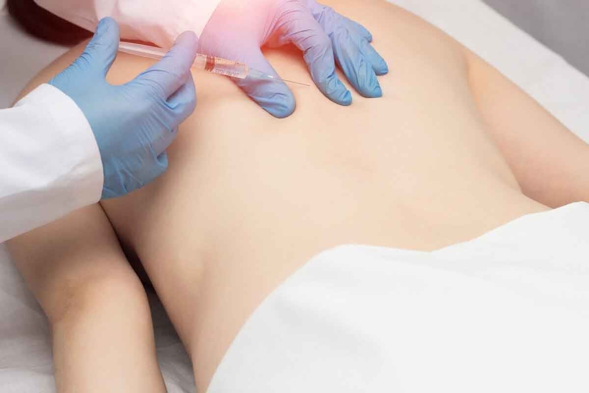 Post Epidural Steroid Injection Care: 12 Essential Aftercare Tips and Restrictions