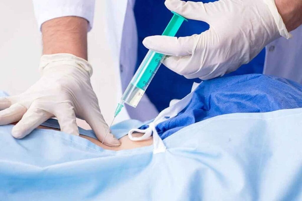 Back Pain After Epidural Steroid Injection Explained