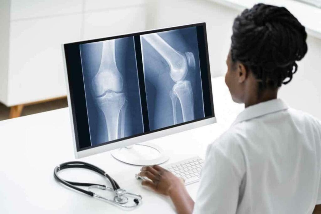 Bone Scan Pictures: 7 Essential & Powerful Facts