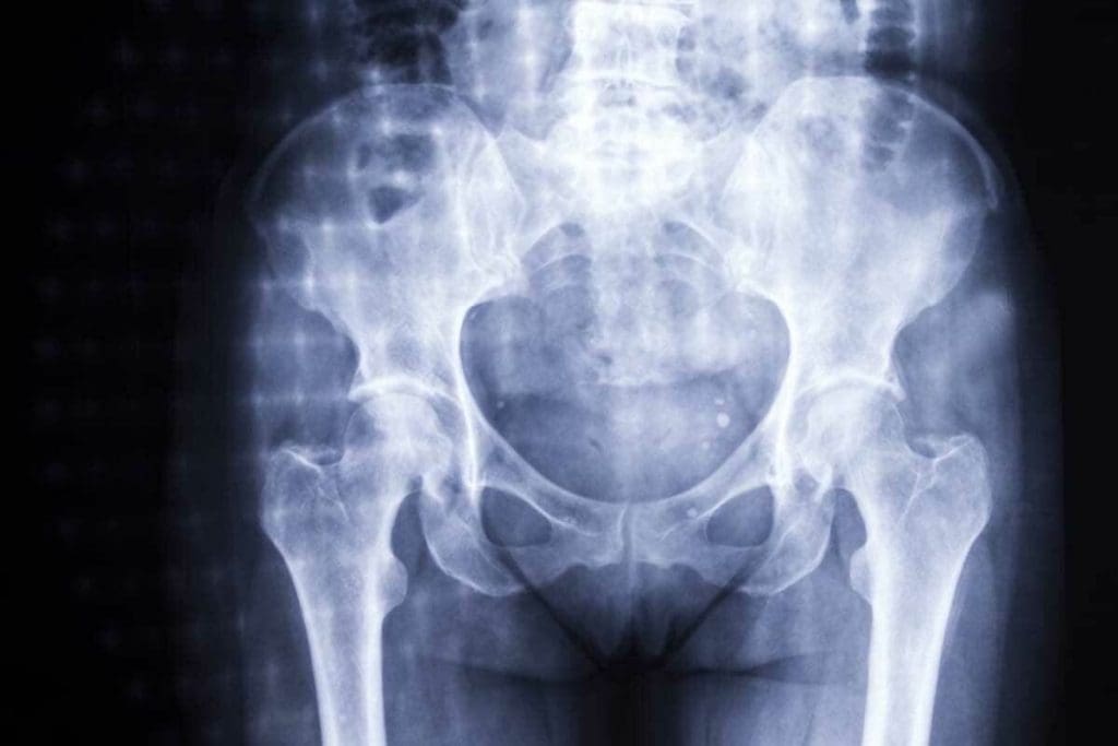 CT vs Bone Scan: Key Differences & Uses