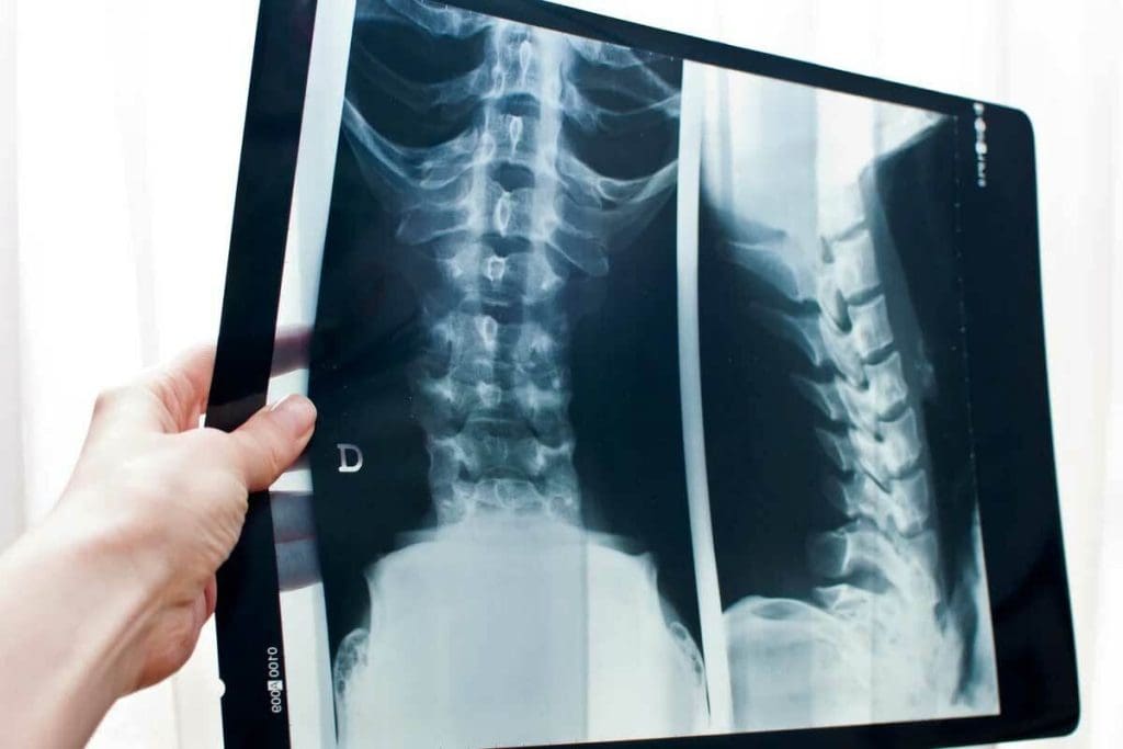 CT vs Bone Scan: Key Differences & Uses