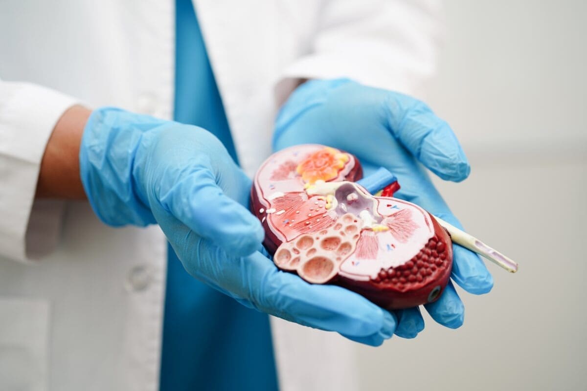 What Does a 2mm Kidney Stone Look Like? Visual Guide