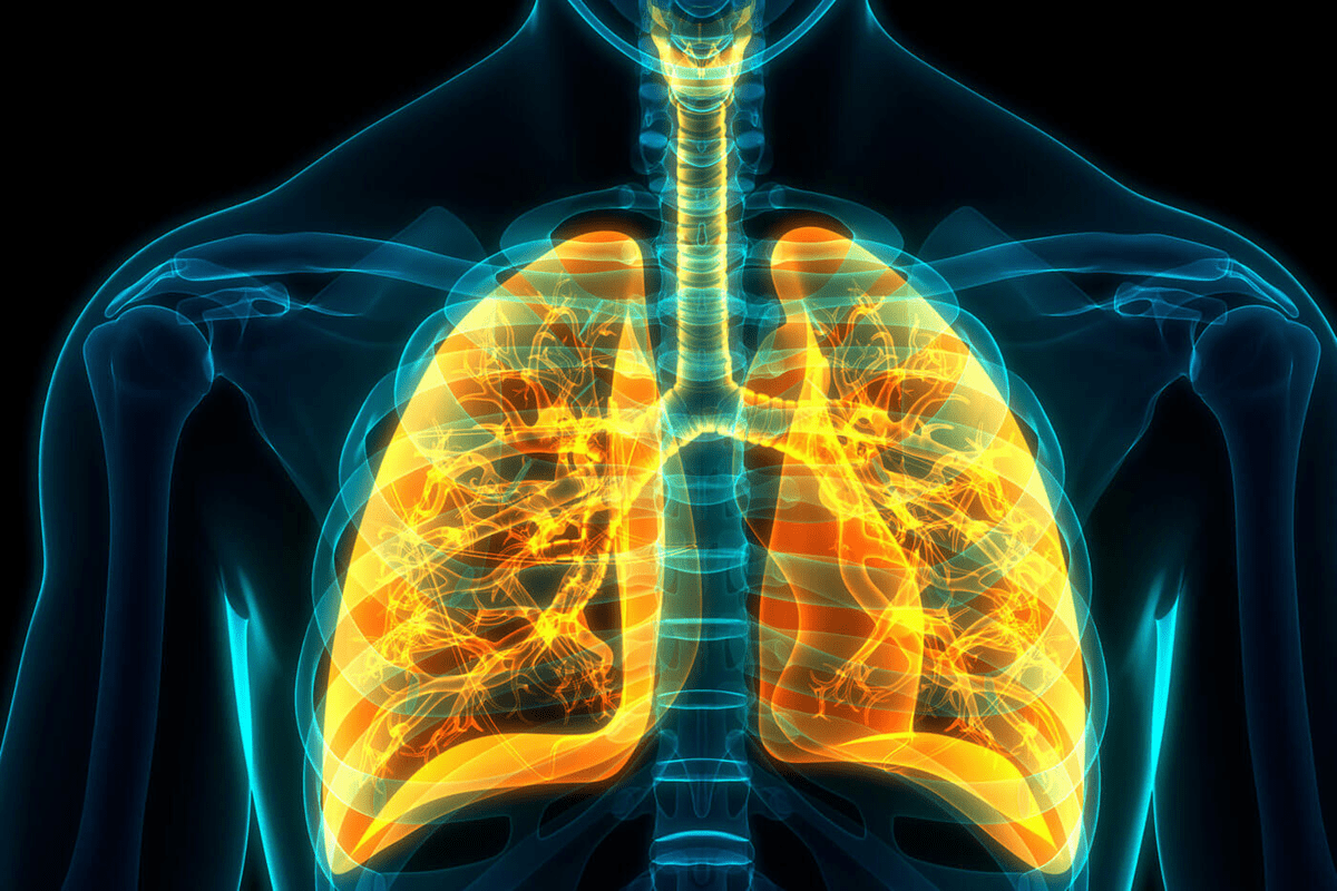 Uncurable Lung Diseases: Understanding the Challenges