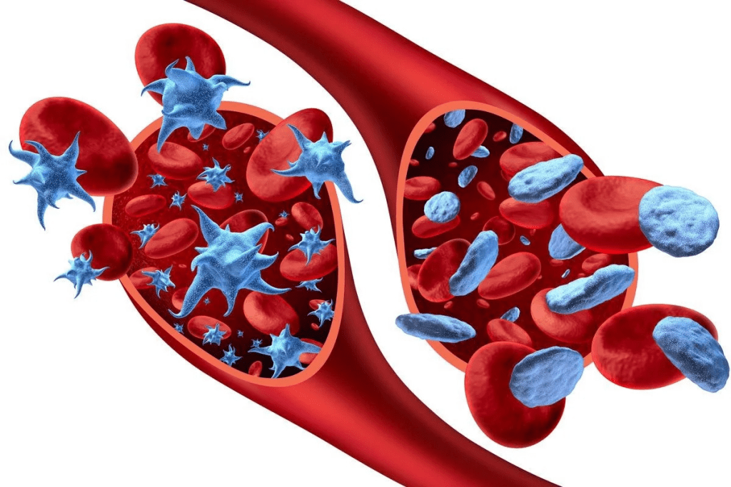 High Platelet Count: Negative Low Platelet Feelings