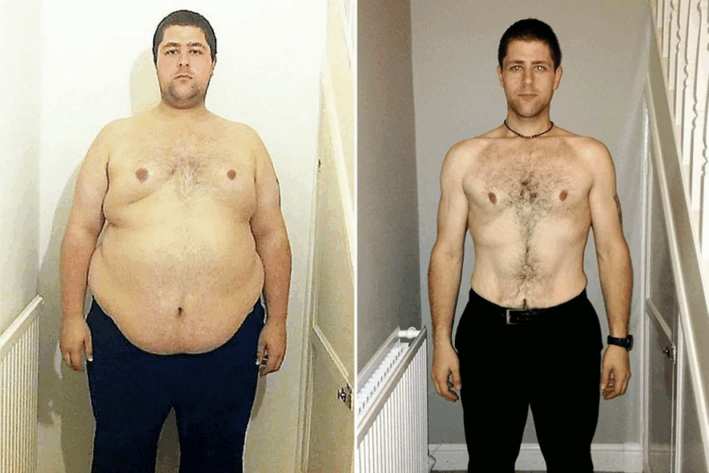 Time to Lose 100 Pounds After Gastric Bypass 3 Time to Lose 100 Pounds After Gastric Bypass