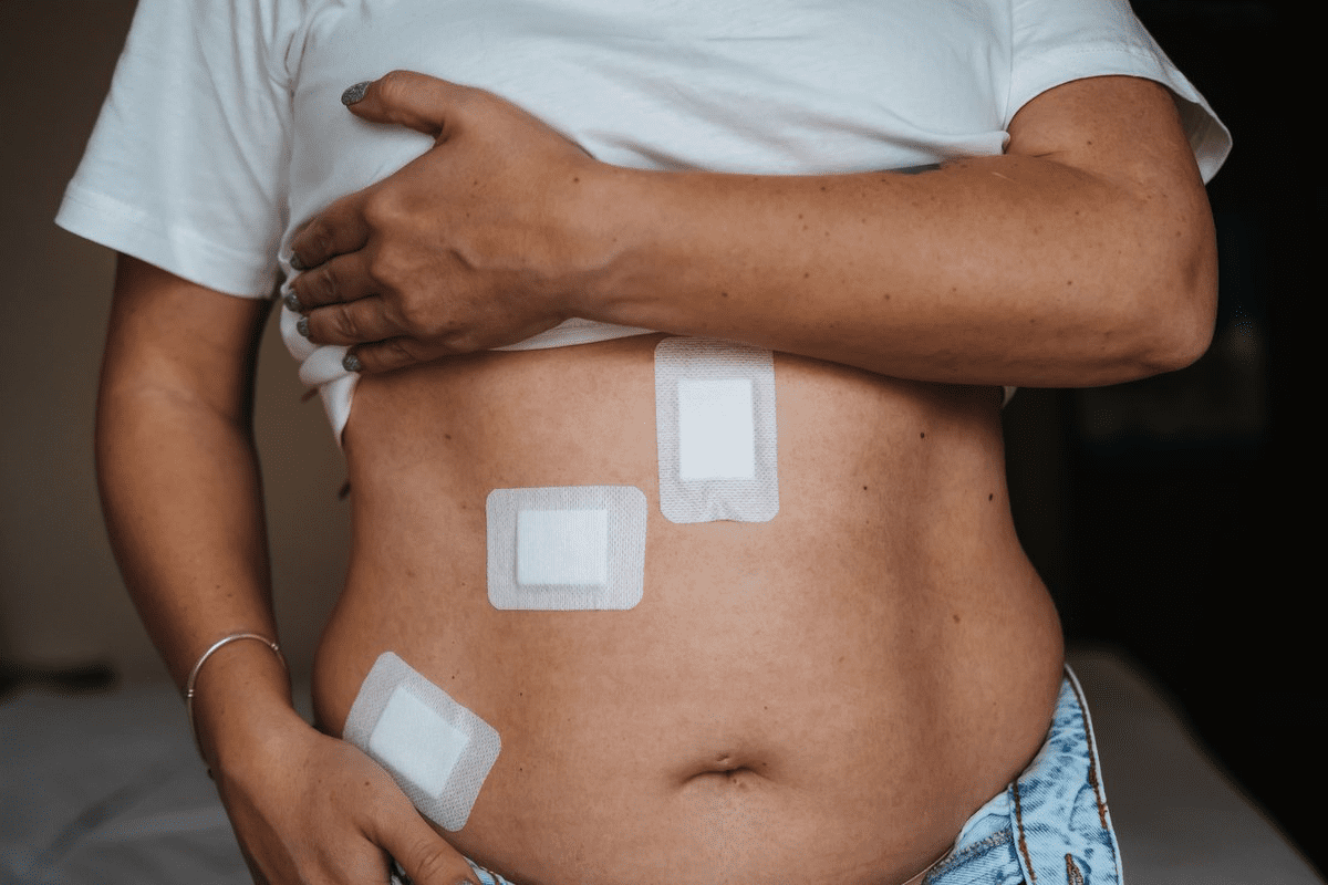 Advanced Hernia Repair Techniques: The Amazing Latest!