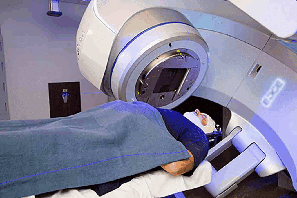 Internal Radiation Therapy: Cancer Treatment Explained