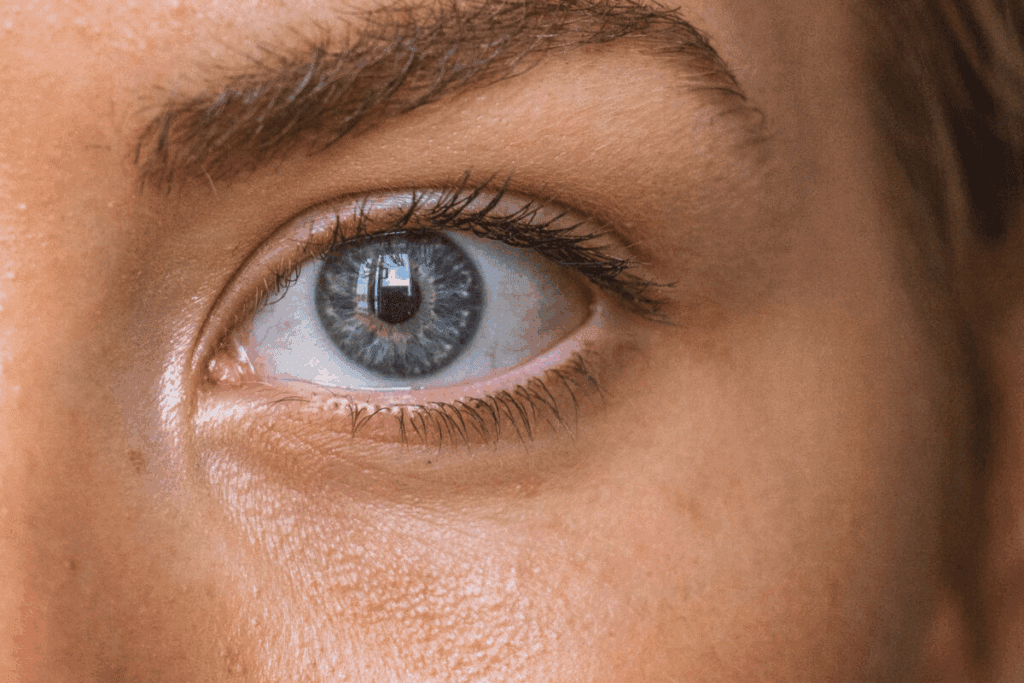 What Do Anemic Eyelids Look Like? Anemia Eyelid Test to Spot Iron Deficiency