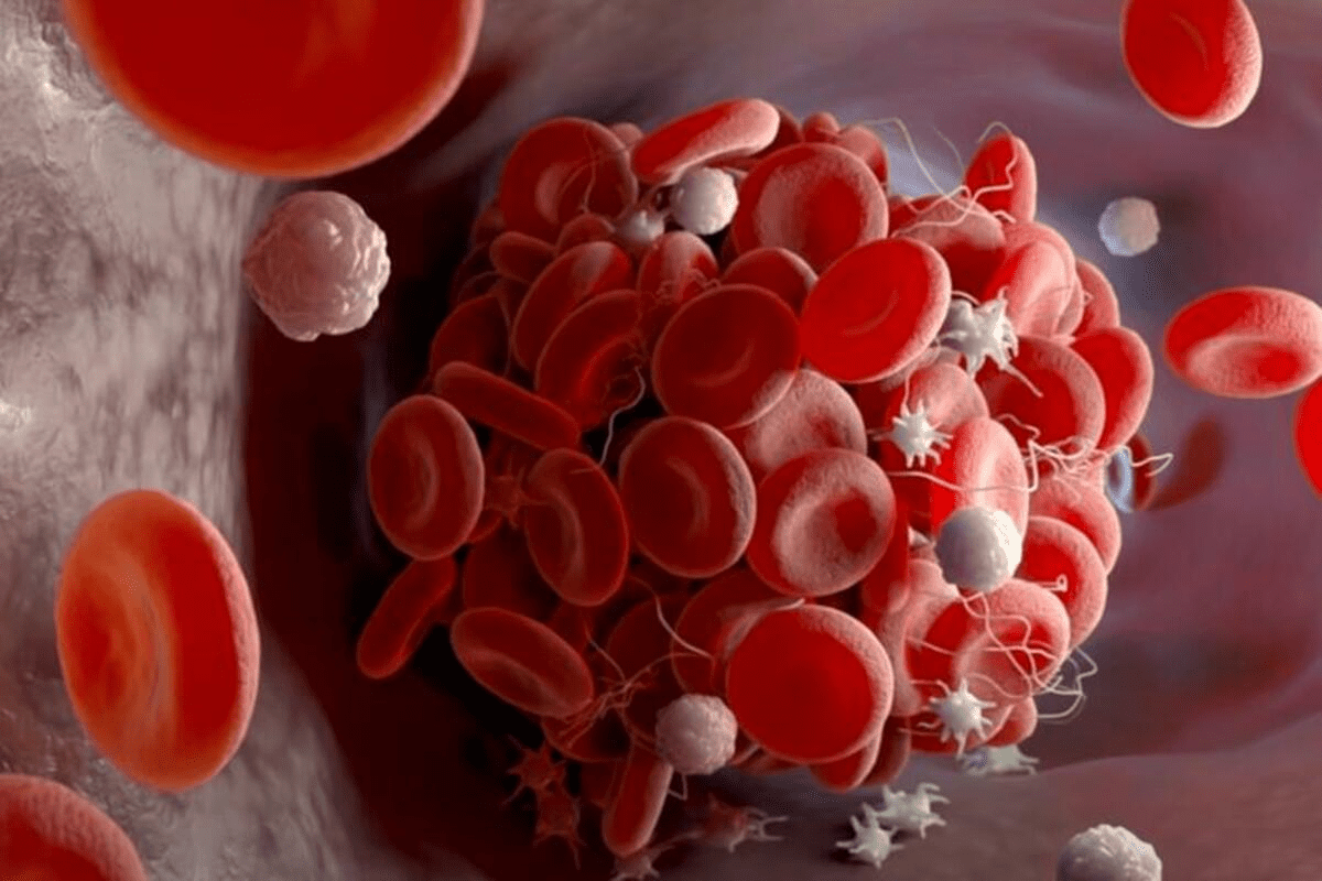 Strategies Sickle Cell Crisis: Amazing Ways to Make It Go Away