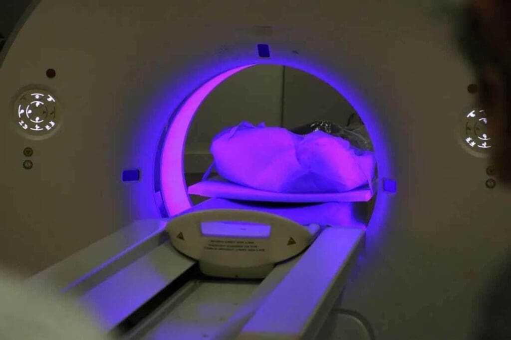 Reaction to Dye CT Scan: 7 Shocking & Key Facts
