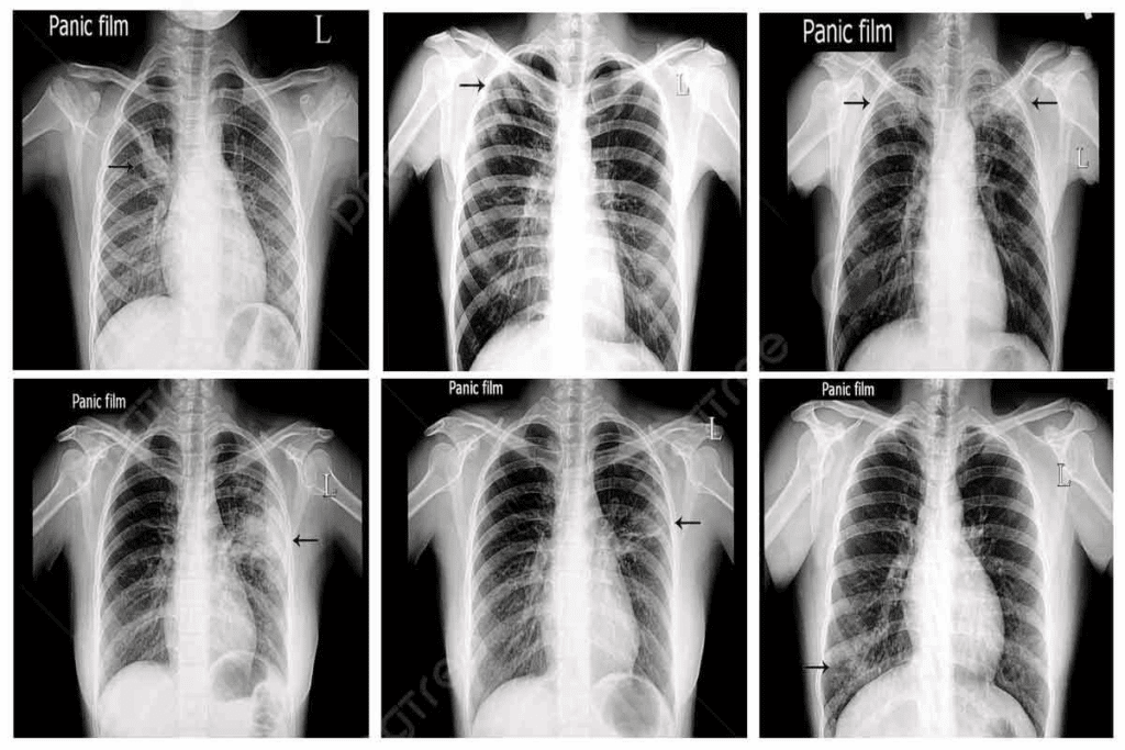 Panoramic X Ray Radiation Dose: An Ultimate Guide 1 Panoramic X Ray Radiation Dose: An Ultimate Guide