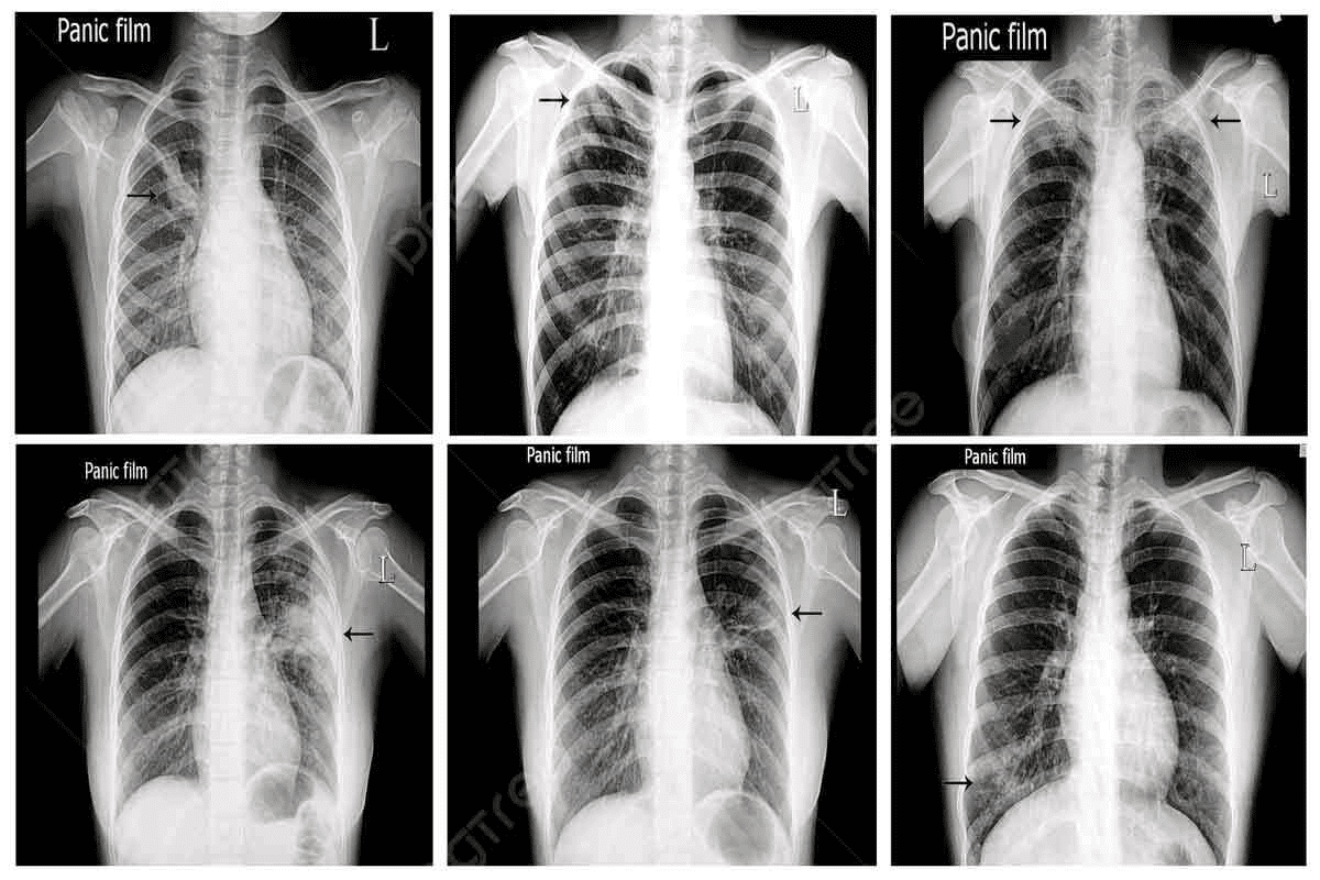 Panoramic X Ray Radiation Dose: An Ultimate Guide