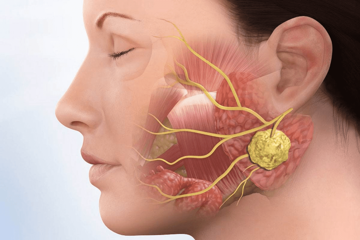 Cancer in the Jaw: Key Symptoms