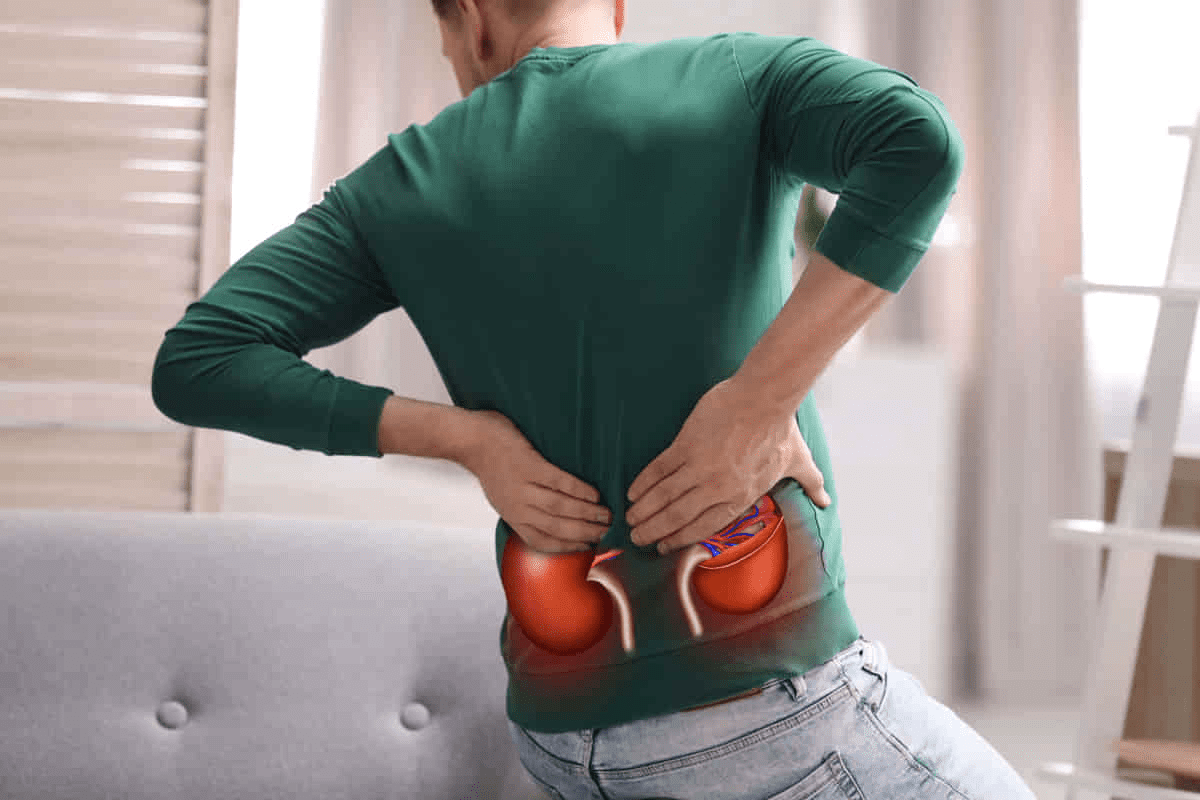 Gout Renal Calculi: Treatment & Prevention