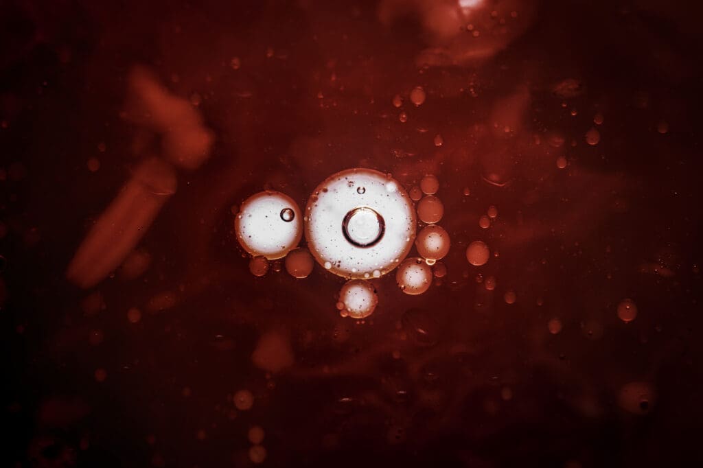 What is another name for myelodysplastic syndrome? 1 infectious coronavirus blood stain 1 LIV Hospital