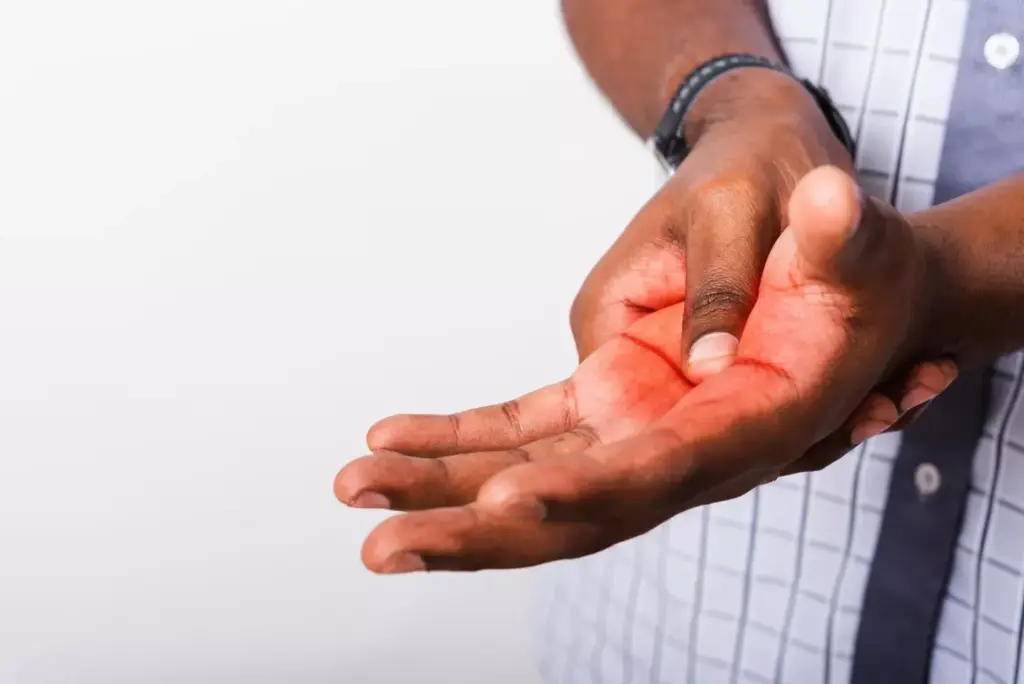 key symptoms of carpal tunnel syndrome