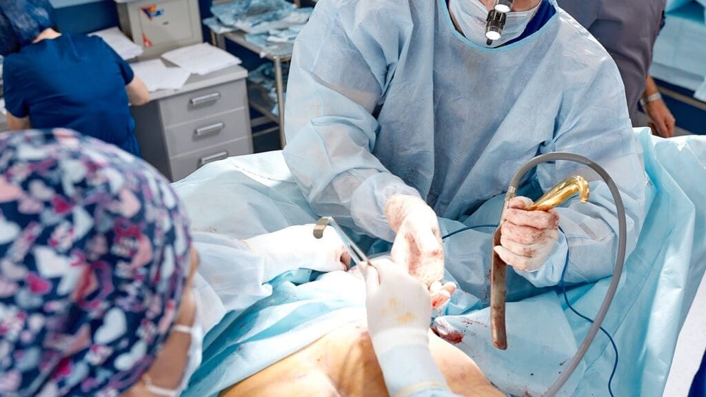 lumbar fusion operation