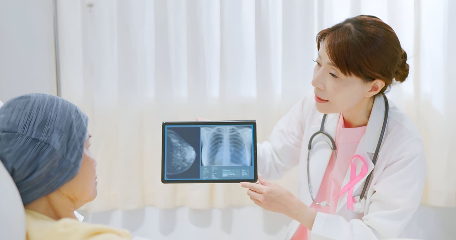 metastatic breast cancer in bones