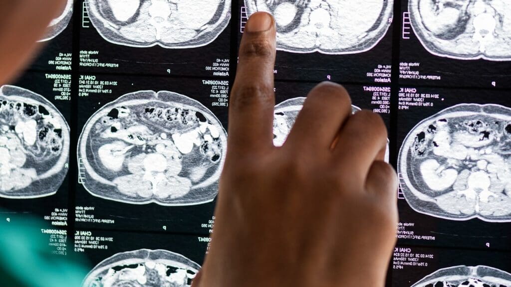 neuroimaging in brain trauma