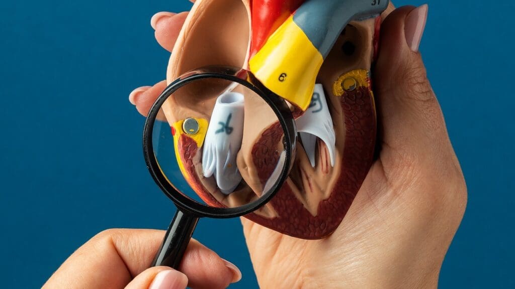 prosthetic heart valve endocarditis