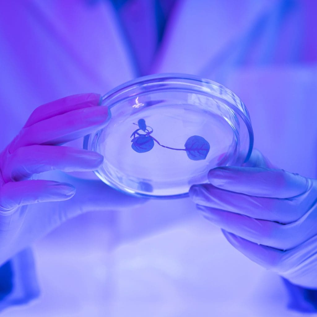 researcher holding petri dish laboratory LIV Hospital