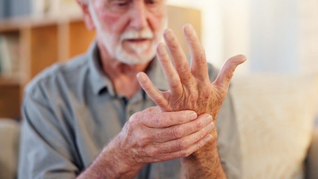severe arthritis impact